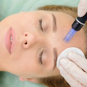 Microneedling